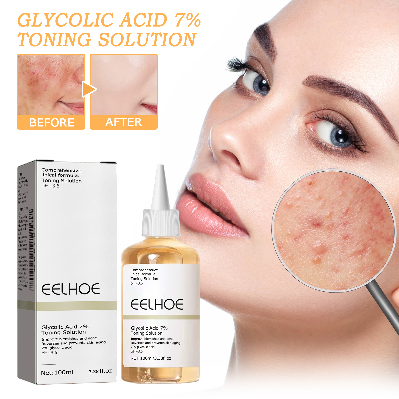 100ml Glycolic Acid Toning Sol - Lactic Acid Toner recensie en prijs