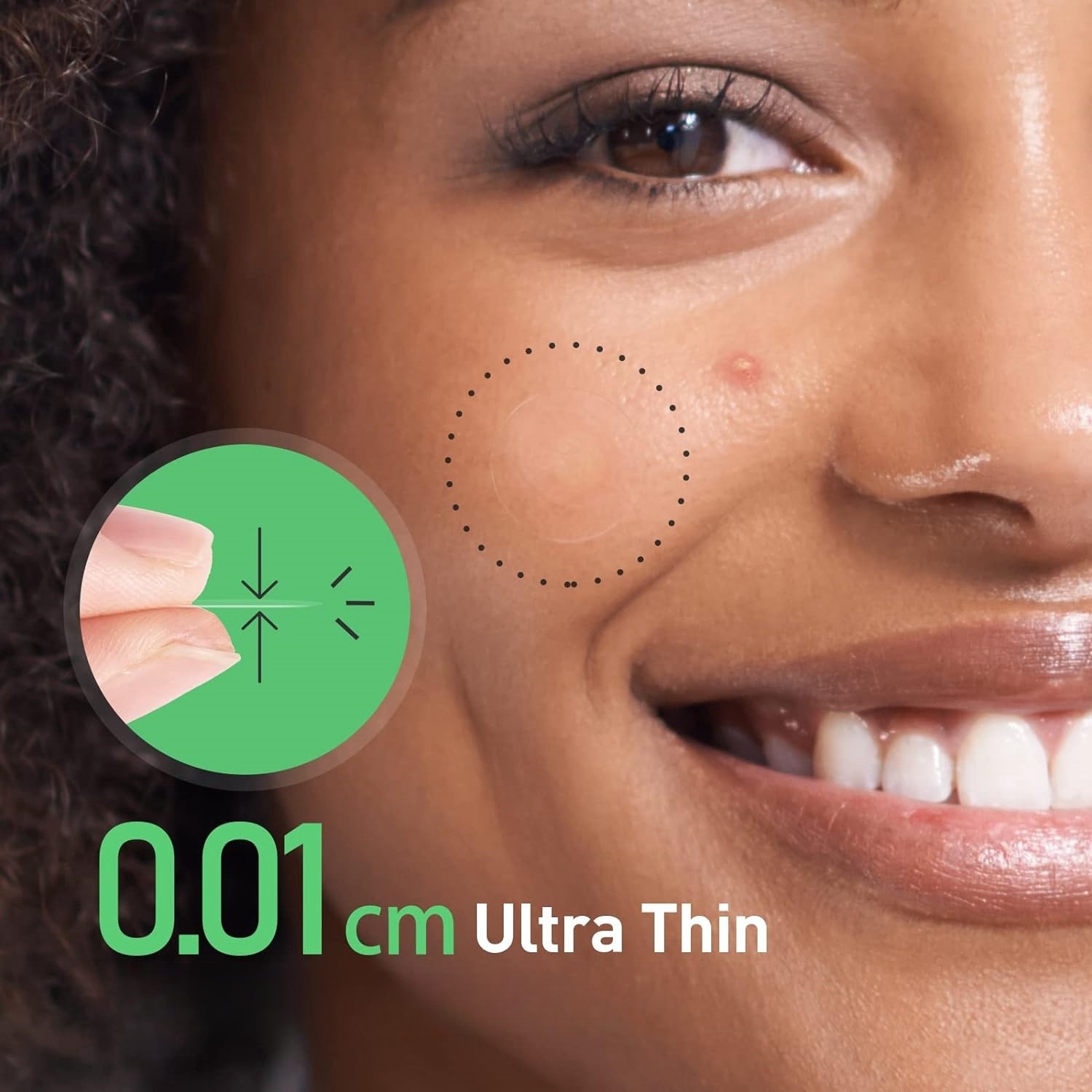 Overnight Micro-Dart Acne Patc - Skincare The Originote recensie en prijs