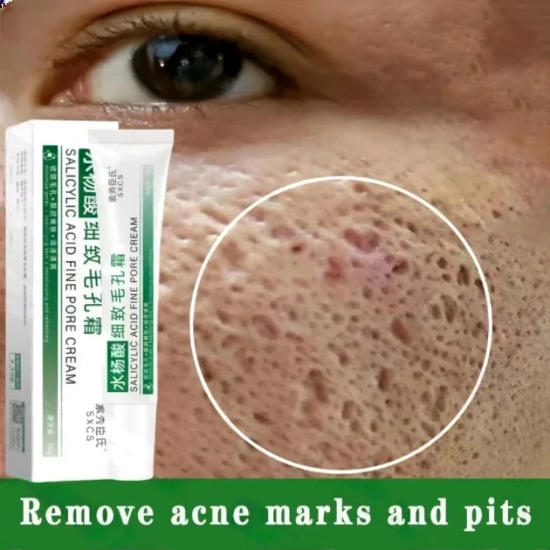 Salicylic Acid Pore Clearing C - Azelaic Acid Cream recensie en prijs
