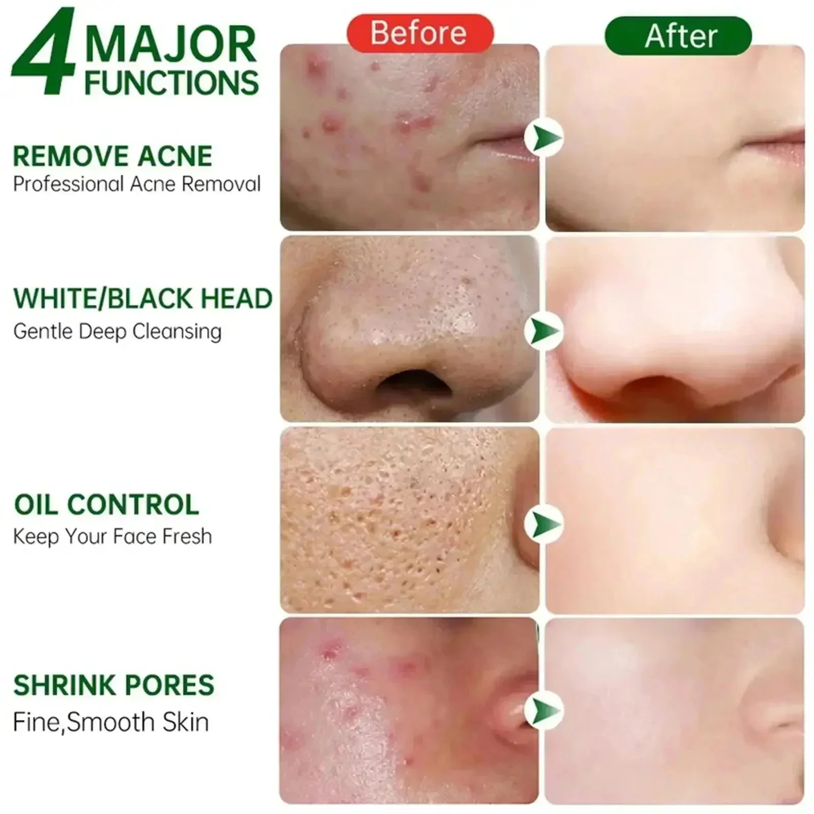 Salicylic Acid Pore Clearing C - Azelaic Acid Cream recensie en prijs