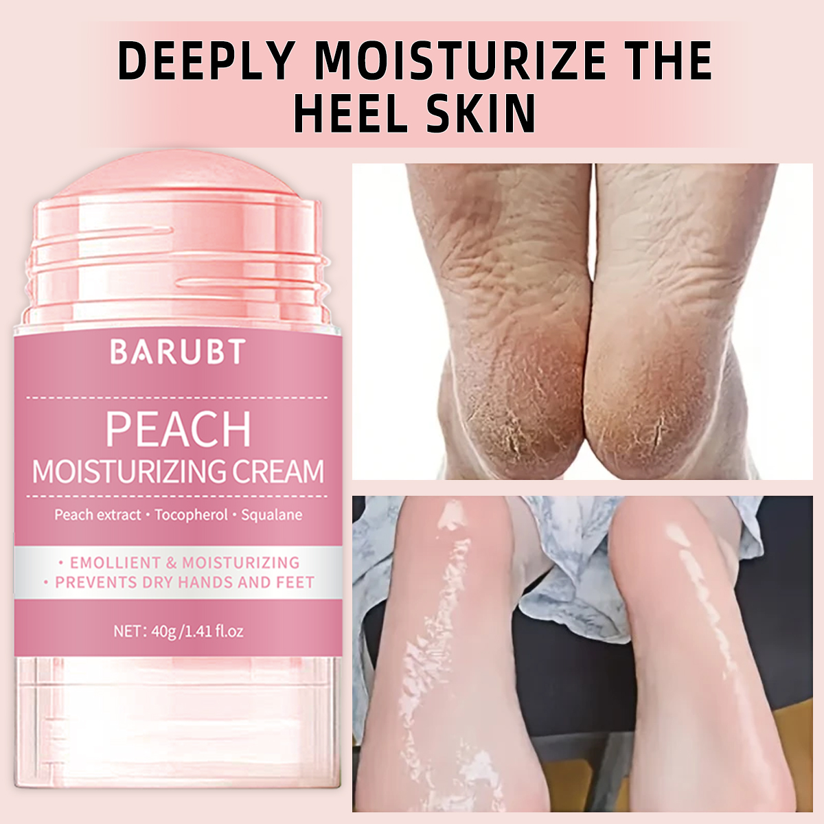 Peach urea mud film rod, salic - Azelaic Acid Cream recensie en prijs