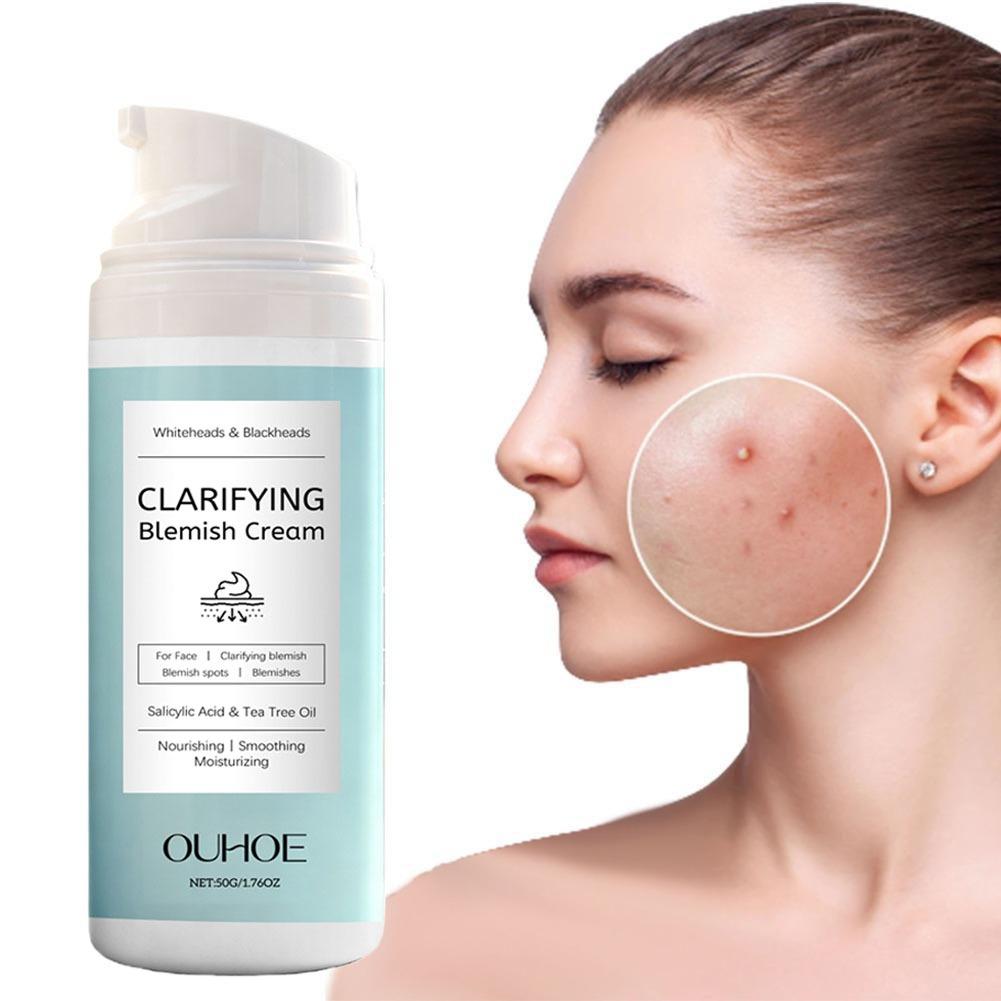 Salicylic Acid Facial Cream fo - Azelaic Acid Cream recensie en prijs