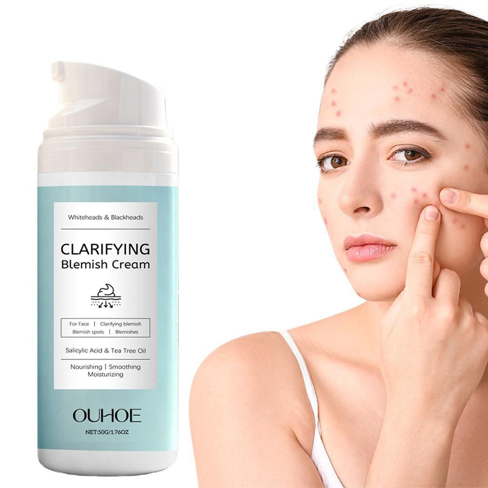 Salicylic Acid Facial Cream fo - Azelaic Acid Cream recensie en prijs