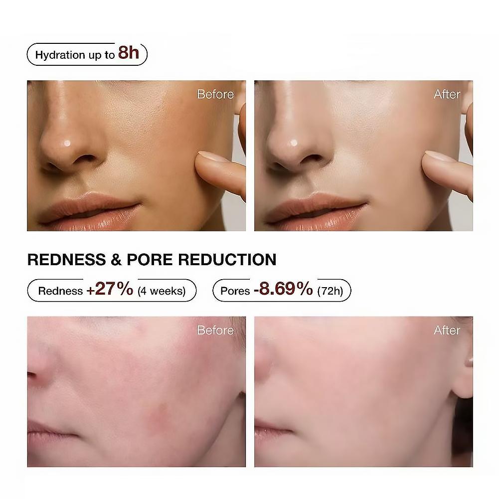 5% Niacinamide & Arbutin Serum - Niacinamide Brightening Serum recensie en prijs