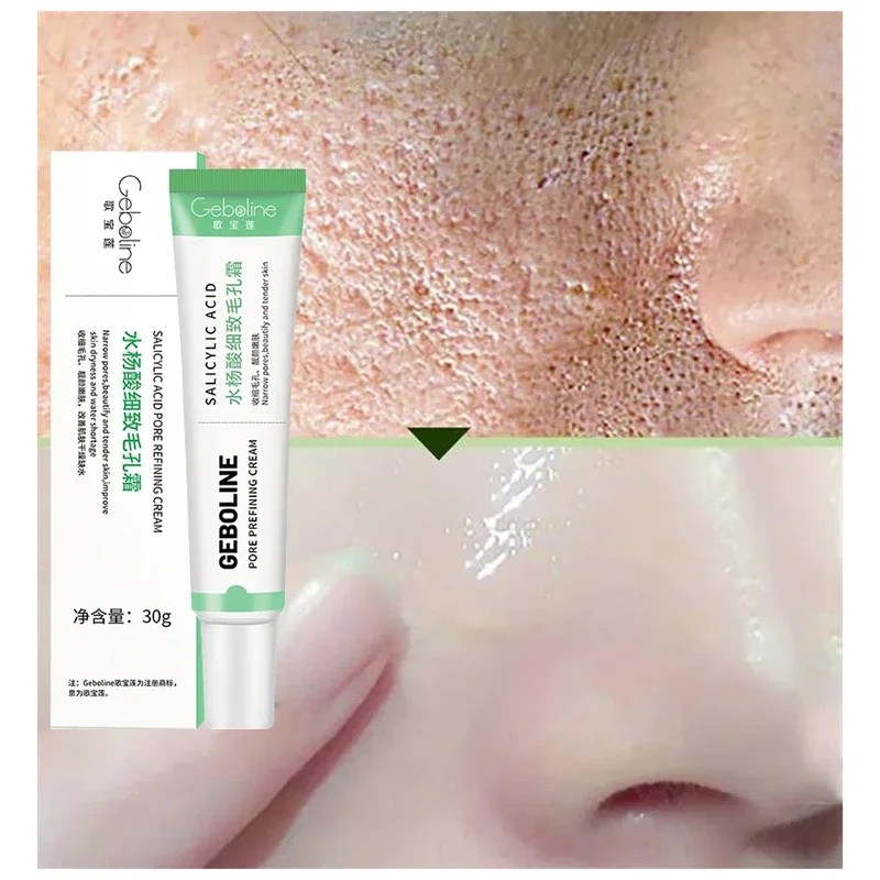 Salicylic Acid Pore Shrinking  - Azelaic Acid Cream recensie en prijs
