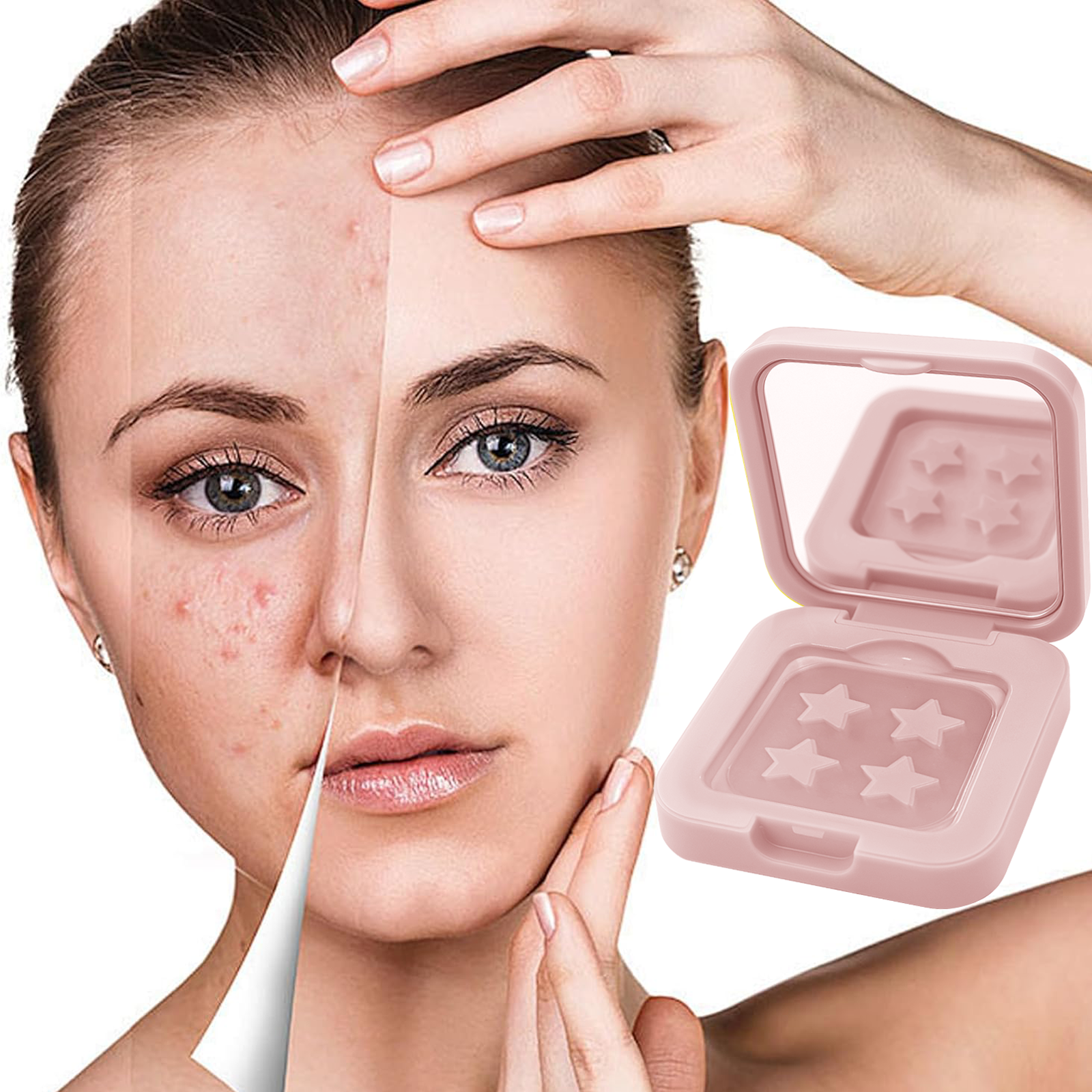 60 Acne Patch, Alcohol and Fra - Skincare The Originote recensie en prijs