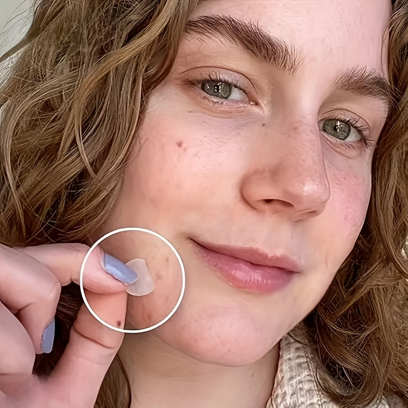 Skin-Calming Acne Patches - Hy - Skincare The Originote recensie en prijs