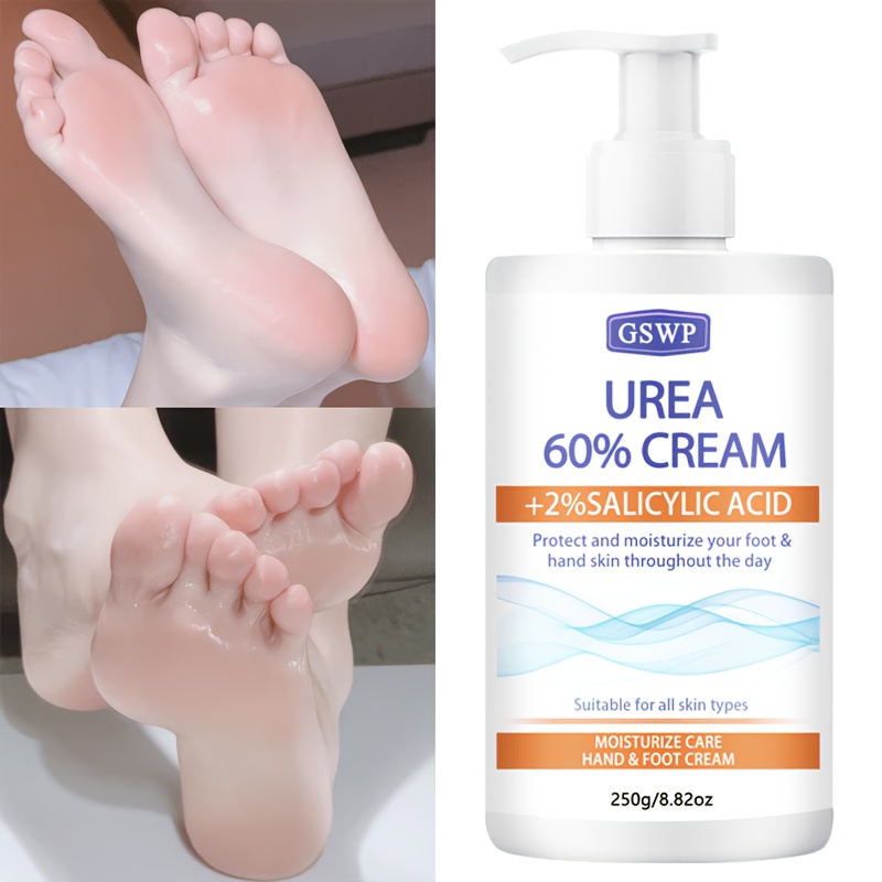 GSWP 60% Urea Moisturising Han - Azelaic Acid Cream recensie en prijs