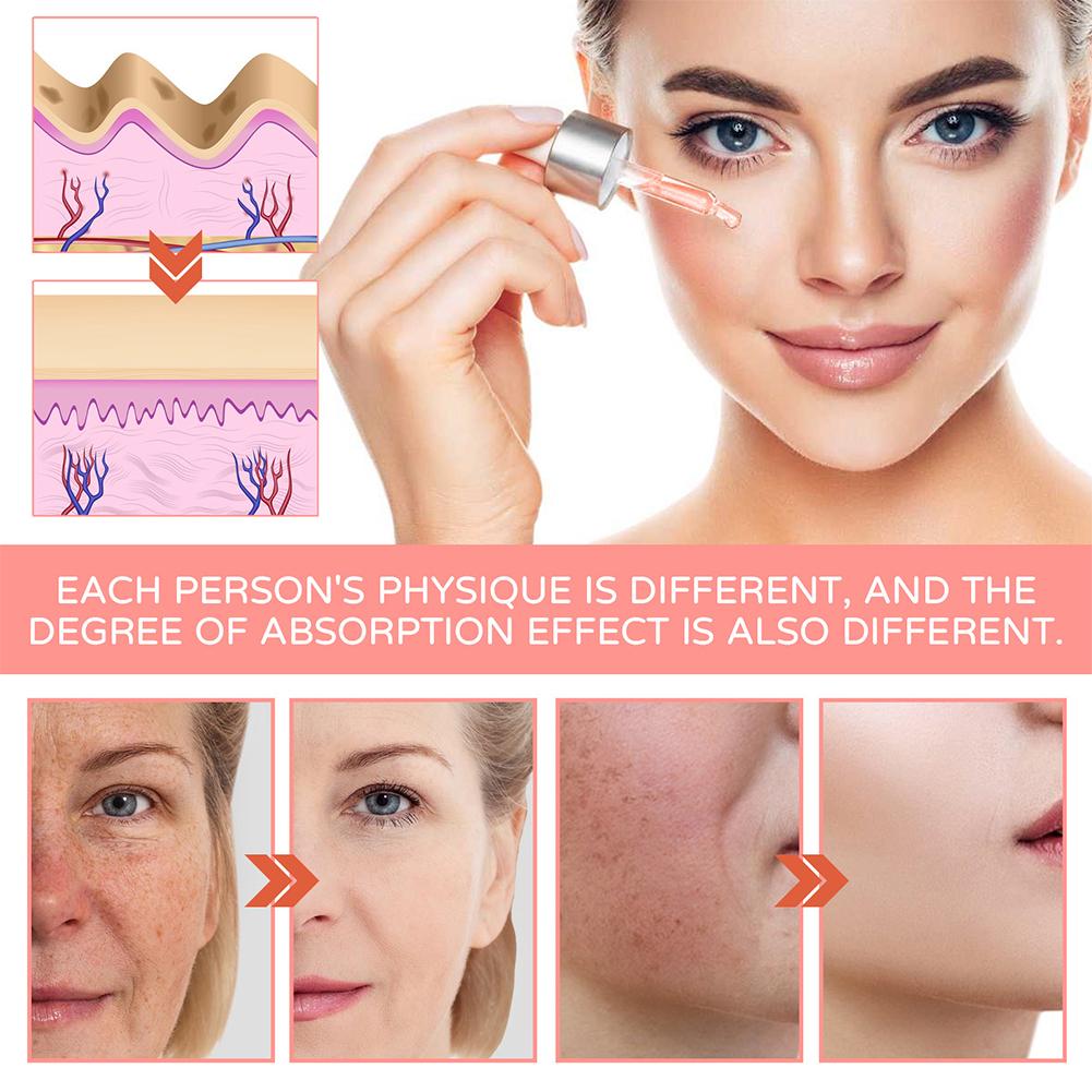 5 in 1 Facial Serum Hyaluronic - Niacinamide Brightening Serum recensie en prijs