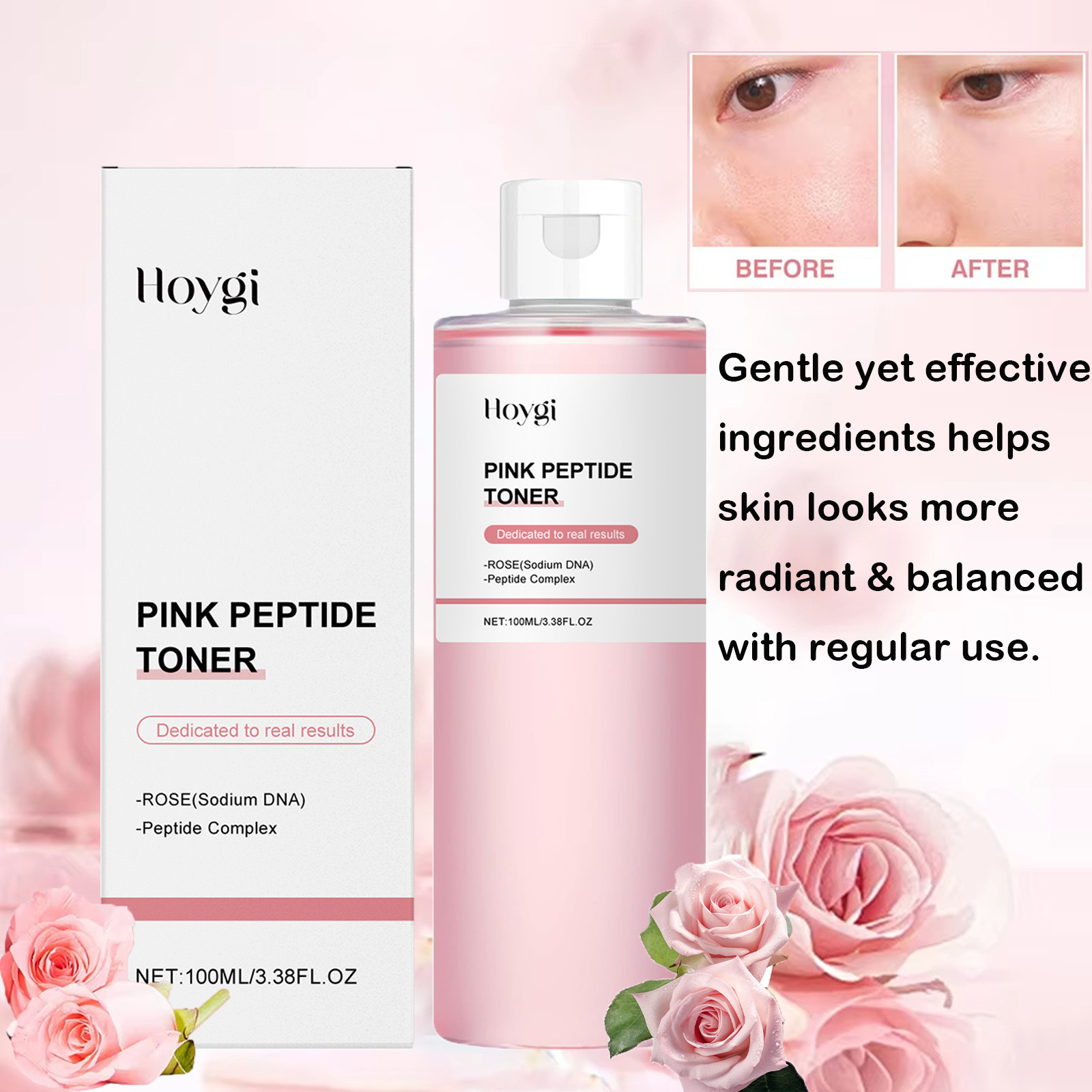 Rose Essence Toner Glowing Ski - Lactic Acid Toner recensie en prijs