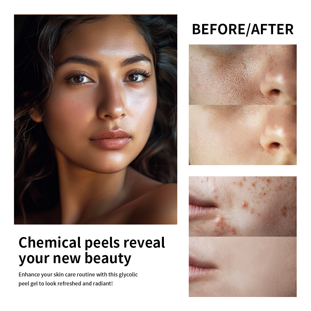 30% Glycolic Acid Face Care Lo - Lactic Acid Toner recensie en prijs