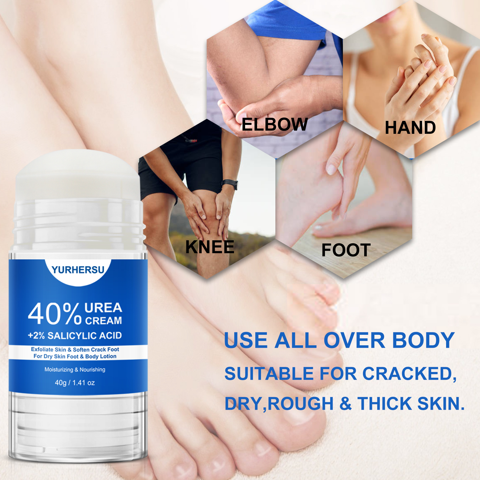40% Urea Foot Cream Stick - Mo - Azelaic Acid Cream recensie en prijs