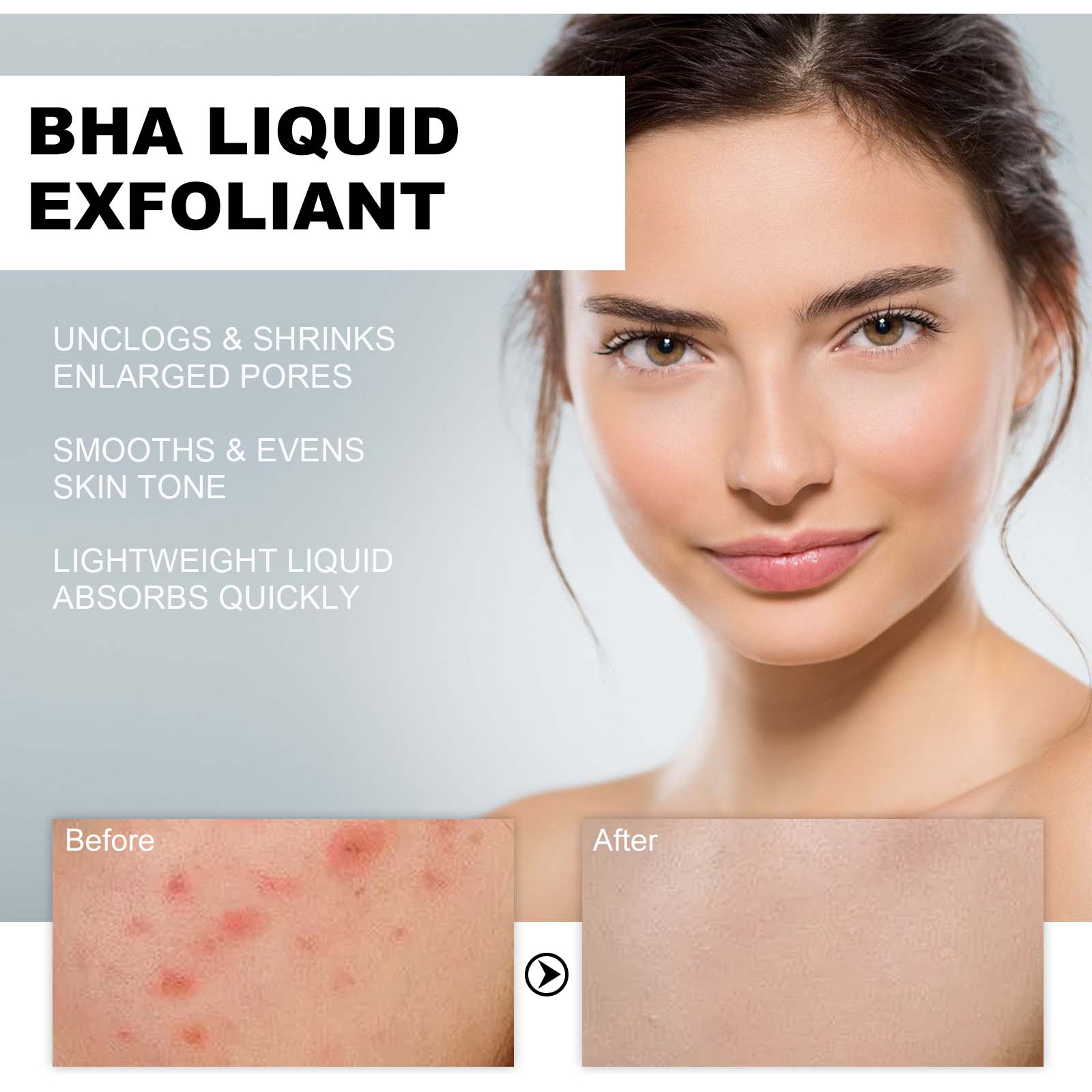 2% Salicylic Acid Liquid Exfol - Lactic Acid Toner recensie en prijs