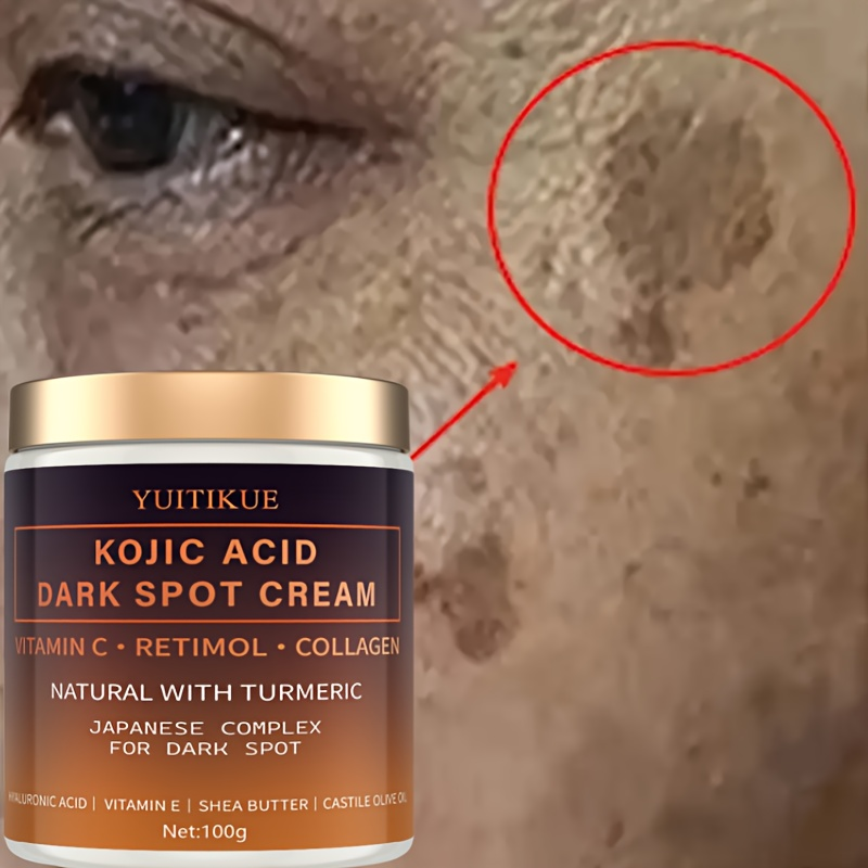 Arbutin fading cream, Vitamin  - Retinol Vitamin A Cream recensie en prijs