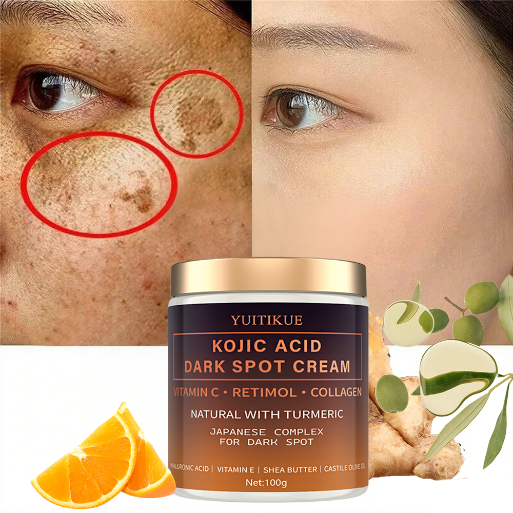 Arbutin fading cream, Vitamin  - Retinol Vitamin A Cream recensie en prijs