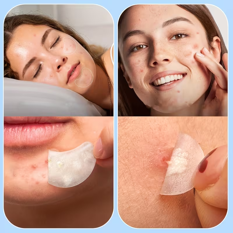 Large Pimple Patches for Face, - Skincare The Originote recensie en prijs